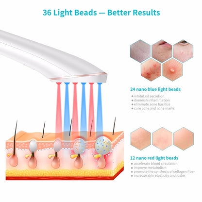 Clear Skin Anywhere – Xpreen Wireless Light Therapy Acne Eraser